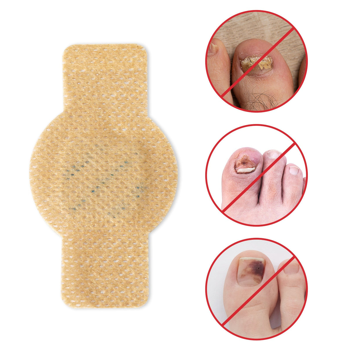 🦶 Nail Repair and Care Correction Patch — For Paronychia and Onychomycosis